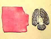 ���X�g���b�N�X����ߒ��Q